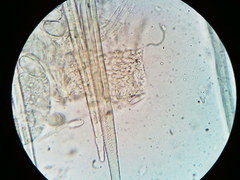 Lasiobolus macrotrichus