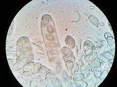 Lasiobolus macrotrichus