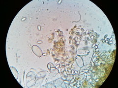 Lasiobolus macrotrichus