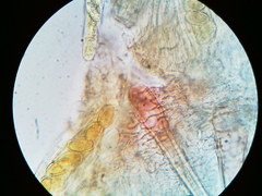 Lasiobolus macrotrichus