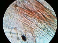 Lasiobolus macrotrichus