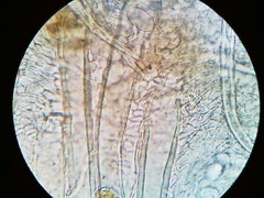 Lasiobolus macrotrichus