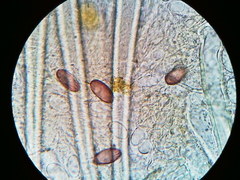 Lasiobolus macrotrichus