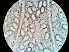 Lasiobolus macrotrichus