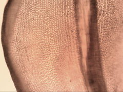 Leptodontium paradoxum