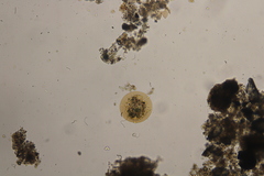 Arcella vulgaris