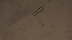Gastrotricha