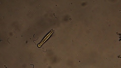 Gastrotricha
