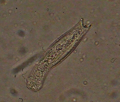 Gastrotricha