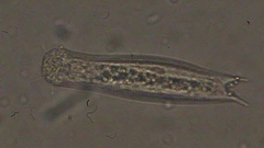 Gastrotricha