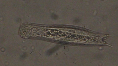 Gastrotricha