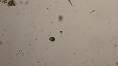 Trachelomonas armata