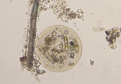 Arcella vulgaris