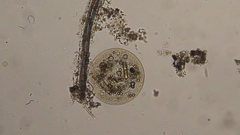Arcella vulgaris