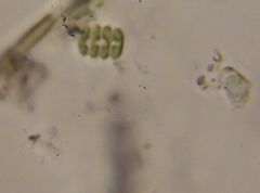 Scenedesmus