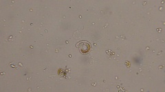 Ophiocytium