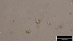 Ophiocytium