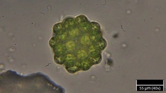 Coelastrum microporum