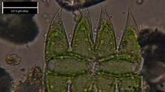 Micrasterias laticeps