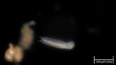 Gastrotricha