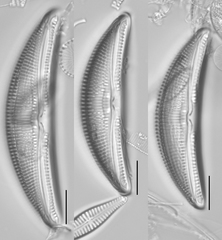 Amphora ovalis