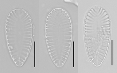 Surirella brebissonii