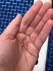 Craspedacusta sowerbii