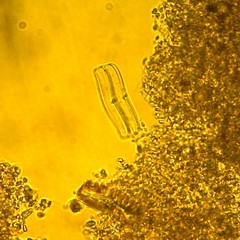 Achnanthidium lineare