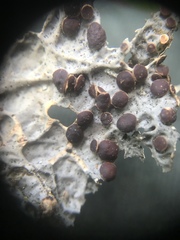Lobaria anthraspis