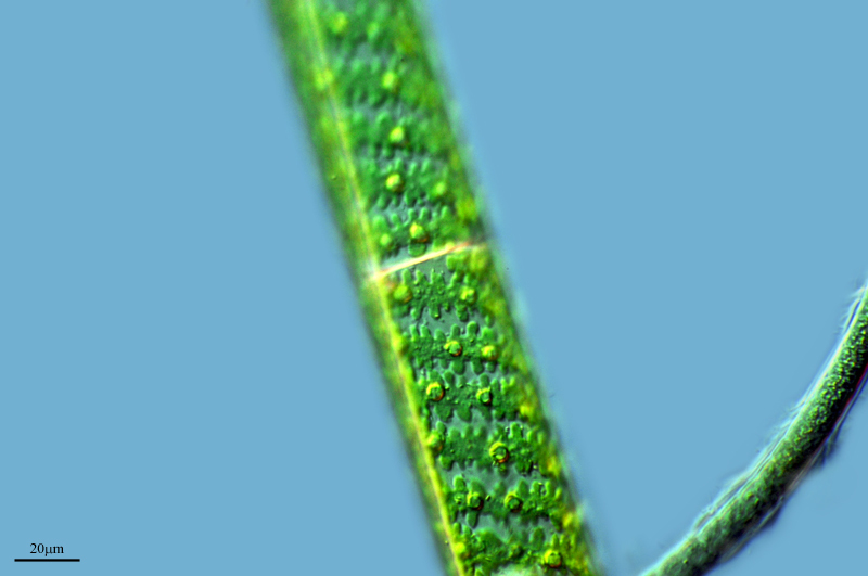 Spirogyra