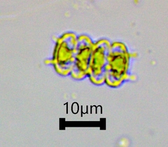 Sphaerozosma filiforme