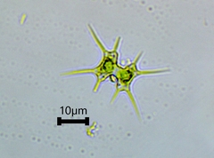 Staurodesmus octocornis