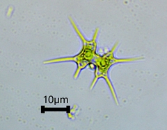 Staurodesmus octocornis