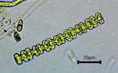 Desmidiaceae