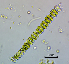 Sphaerozosma filiforme