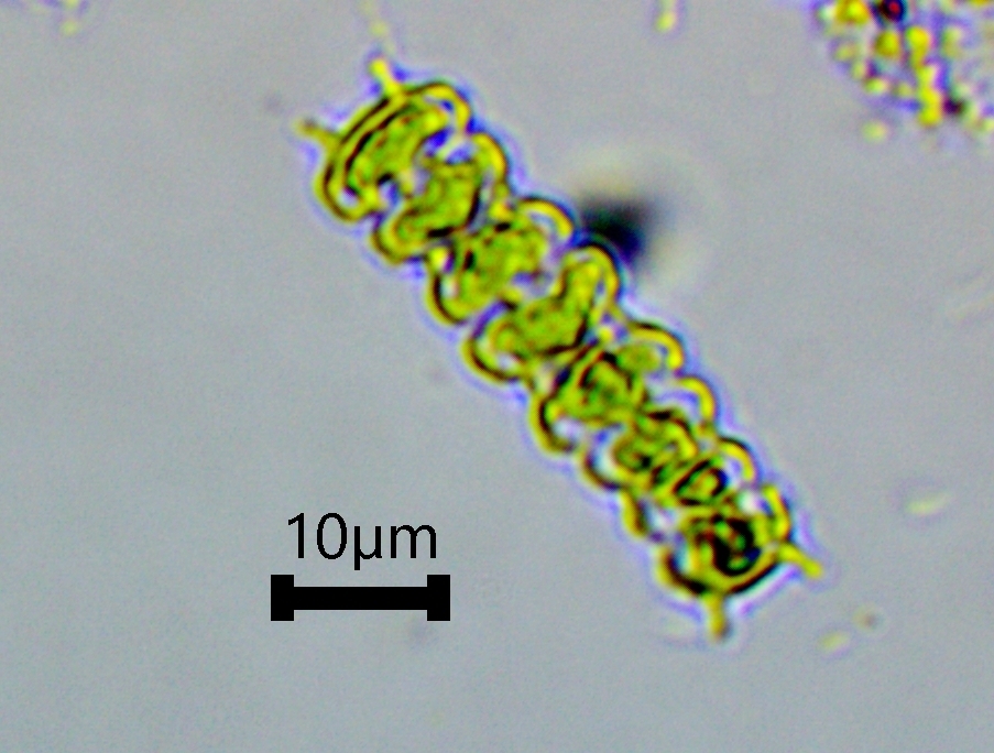 Sphaerozosma filiforme