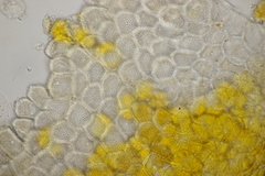 Puccinia difformis