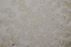 Pucciniastrum circaeae
