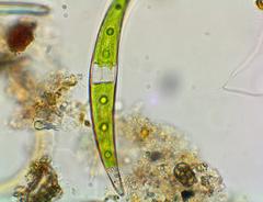 Closterium dianae