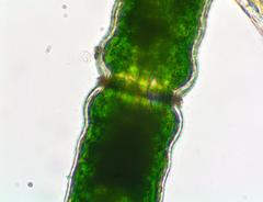 Pleurotaenium coronatum