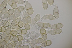 Puccinia annularis