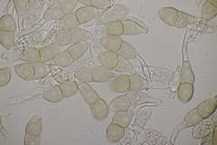 Puccinia annularis