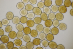 Uromyces polygoni-avicularis