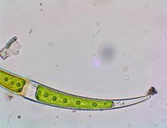 Closterium dianae