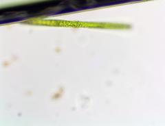 Pleurotaenium trabecula