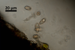 Dermatocarpon leptophyllodes