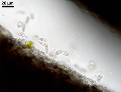 Dermatocarpon leptophyllodes