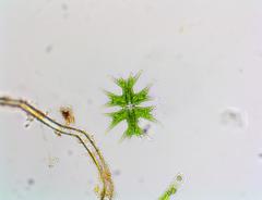 Micrasterias mahabuleshwarensis