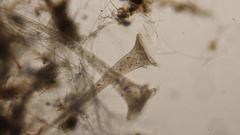 Stentor roeselii