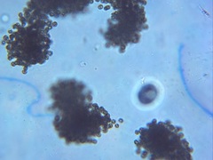 Microcystis